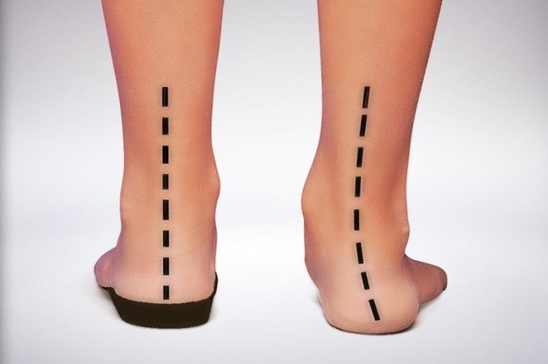 Jakie wkładki do butów wybrać, aby zadbać o komfort stóp?